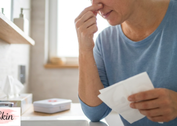 how to stop bleeding nose