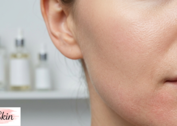 skin barrier repair