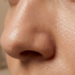 large pores on nose
