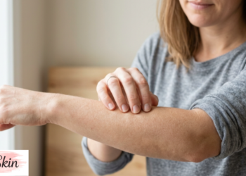itchy skin no rash