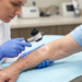 Actinic Keratosis Pictures