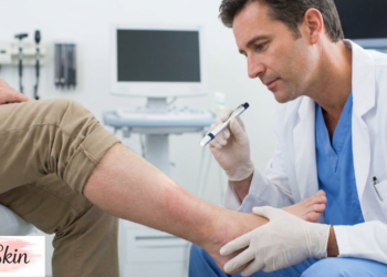 cellulitis treatment