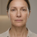 mottled skin