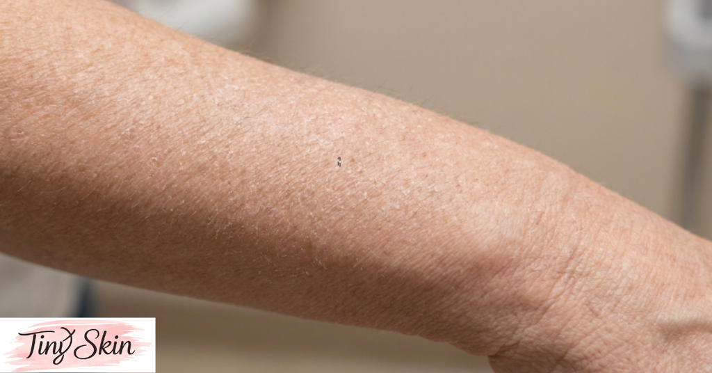 how to remove dead skin from body