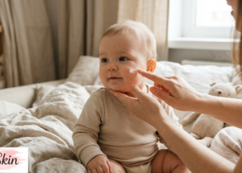 baby dry skin on face